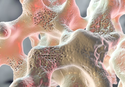 The Role of Vitamin K2 in Blood Clotting